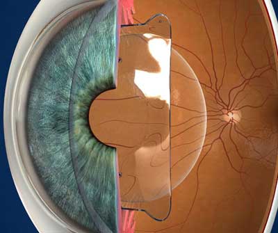 Best Ophthalmologist in Jabalpur