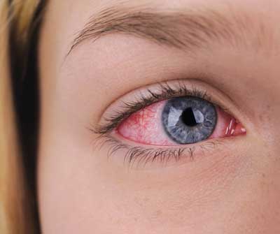 Lasik Treatment in Jabalpur